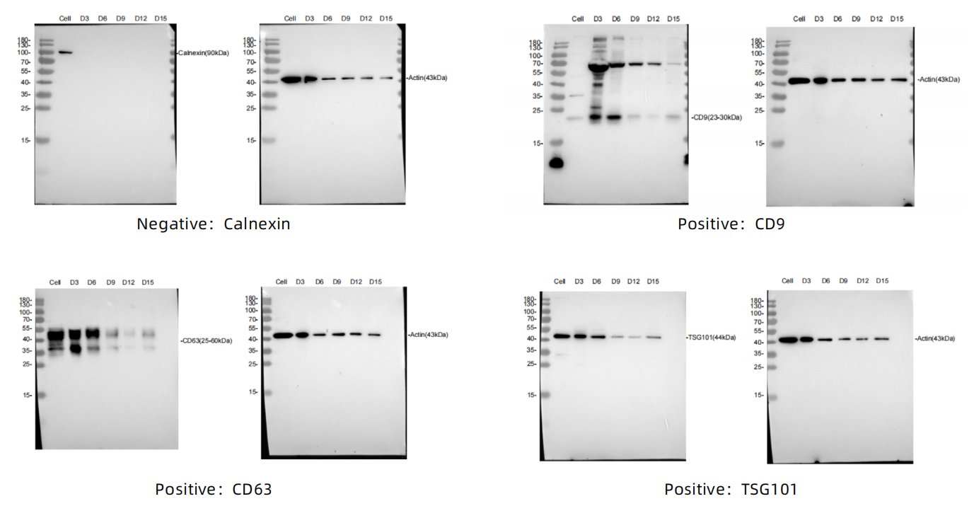 Western -Blot（WB）によってタンパク質マーカーを検出する
